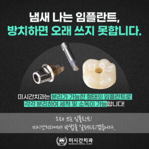23.10.24_미시간치과_분리형_임플란트_관리_세척_시안02