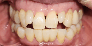 연산동치과