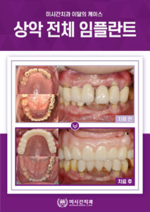 미시간치과