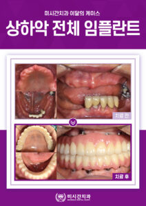 치료기간 : 2022.10 ~ 2023.07