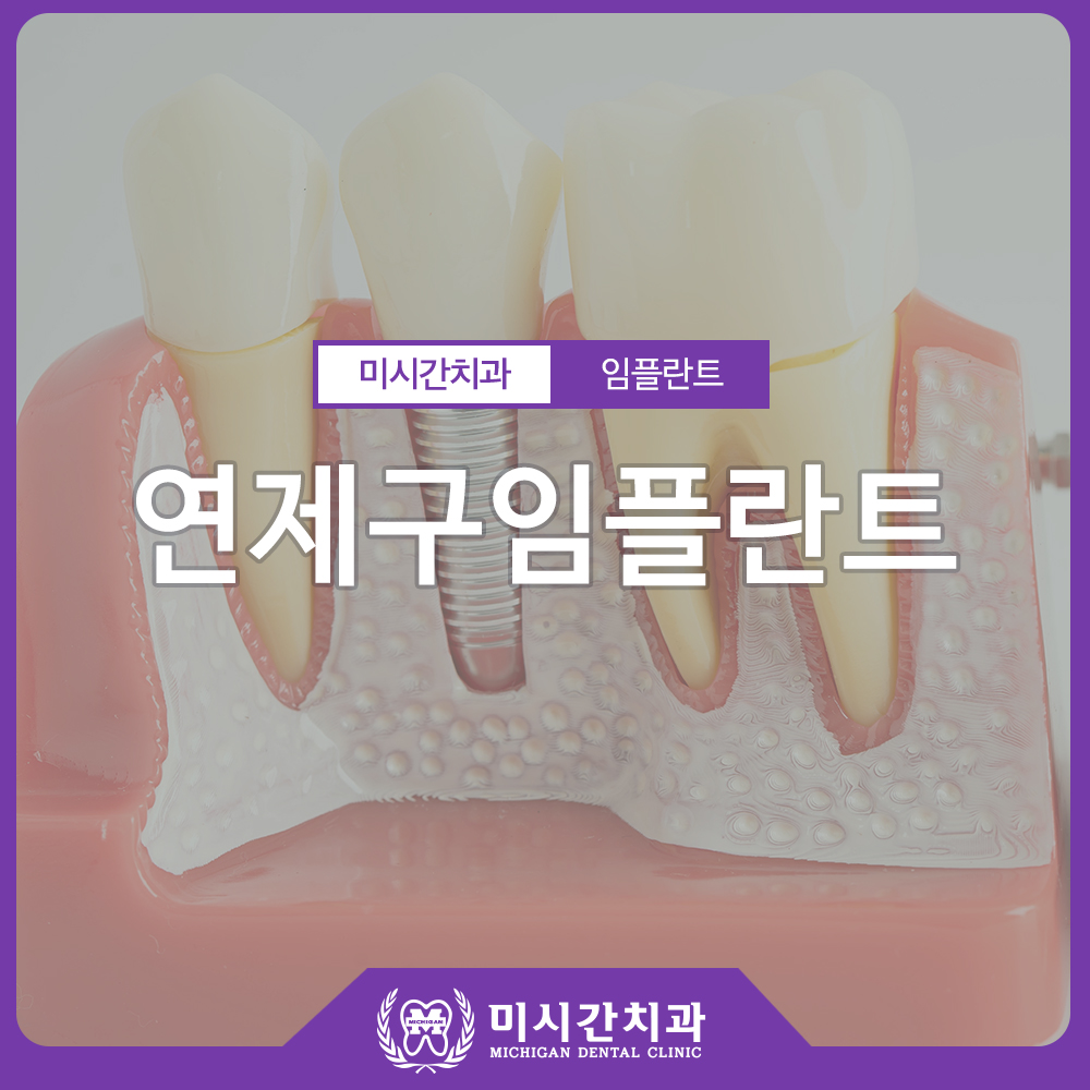 0409 미시간이관 1