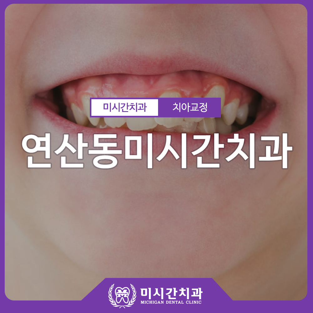 0423 이관 1