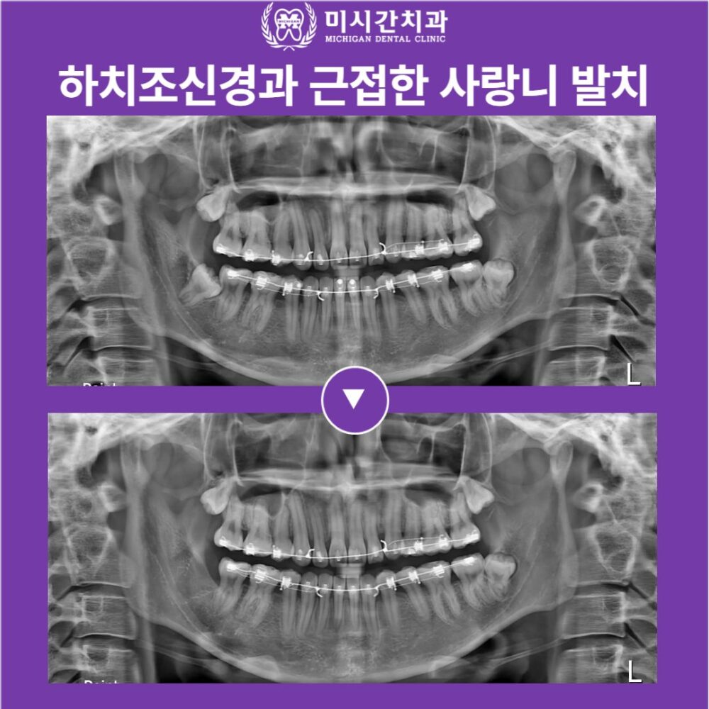 연산동치과
