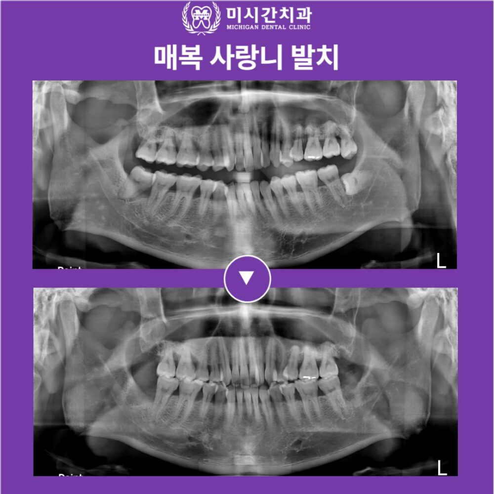 연산동치과
